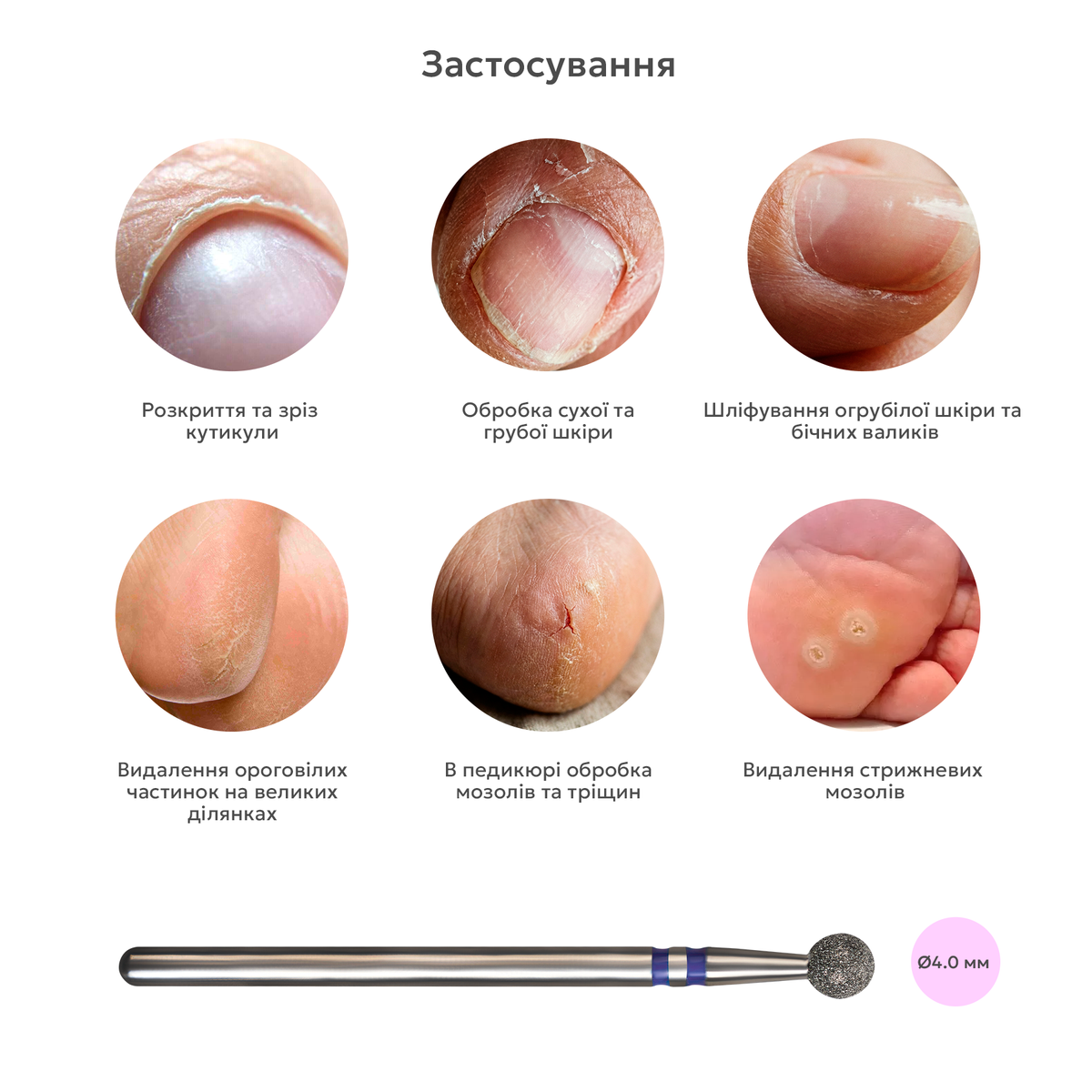 застосування алмазної фрези куля фіолетова