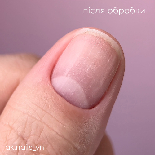 Ноготь после обработки фрезами для аппаратного маникюра
