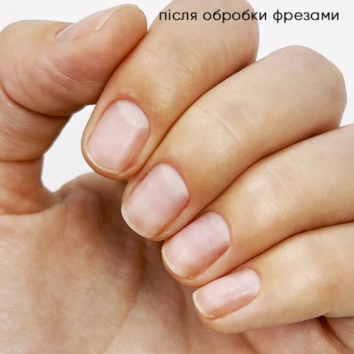 Кутикула и боковые валики после обработки фрезами для маникюра