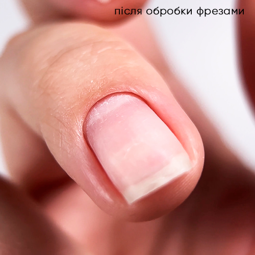 РРезультат обработки кутикулы и боковых валиков фрезами для маникюра