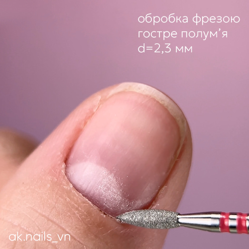 Обработка кутикулы острым пламенем 2,3 мм с красным абразивом