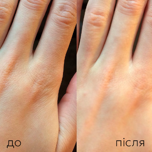 Кожа рук до и после регулярного ухода